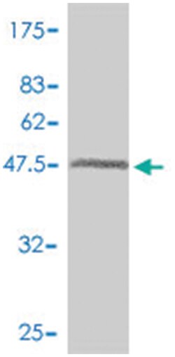NOTCH2NL, Mouse, Polyclonal Antibody, Abnova 50&mu;L; Unlabeled:Antibodies,