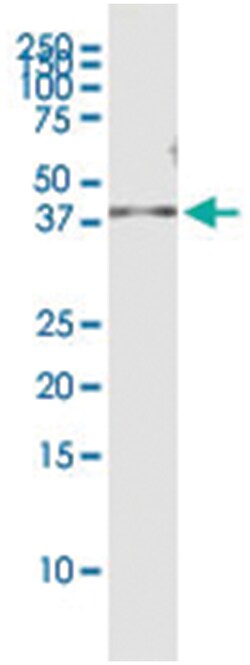 anti-VGLL3, Human, IP-WB Antibody Pair, Abnova 1 Set:Antibodies, Monoclonal/Polyclonal