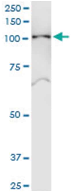 anti-SNX19, Human, IP-WB Antibody Pair, Abnova 1 Set:Antibodies, Monoclonal/Polyclonal