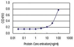 anti-CENPP Matched Antibody Pair, Abnova&trade;