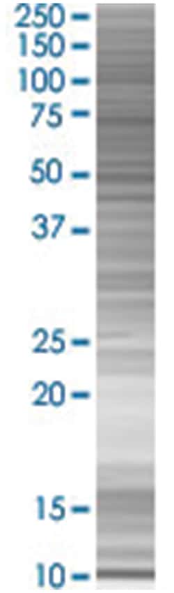 INCA 293T Cell Overexpression Lysate (Denatured), Abnova 100 &mu;L | Buy Online | Abnova | Fisher Scientific