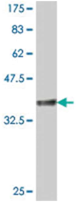 EIF2AK4, Mouse, Polyclonal Antibody, Abnova 50&mu;L; Unlabeled:Antibodies,