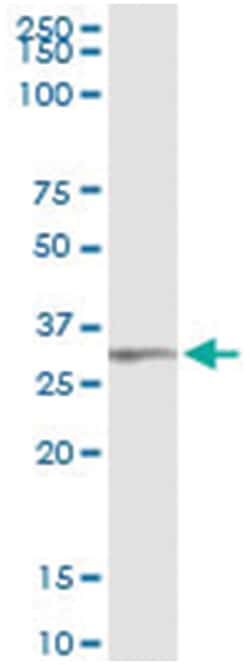 TRIM72, Human, IP-WB Antibody Pair (PW1), Abnova&trade;