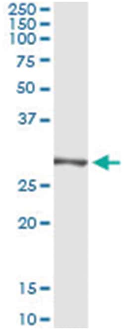 TRIM72, Human, IP-WB Antibody Pair (PW2), Abnova 1 Set:Antibodies, Monoclonal/Polyclonal