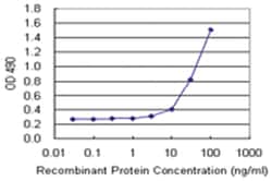 SFTPA1, Human, Matched Antibody Pair (AP42), Abnova™