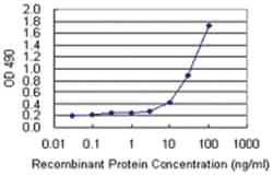 SFTPA1, Human, Matched Antibody Pair (AP43), Abnova&trade;