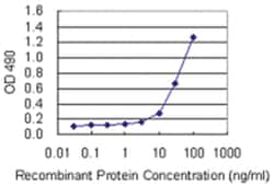 SFTPA1, Human, Matched Antibody Pair (AP44), Abnova 1 Set | Buy Online | Abnova Corporation | Fisher Scientific