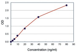 Abnova&trade;&nbsp;SAA (Human) ELISA Kit