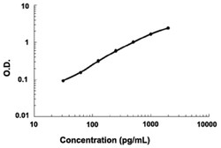 Abnova Use to measure quantitatively human IL6R. Sandwich enzyme immunoassay. CCS, Plasma (EDTA, Heparin), Saliva, Serum, Urine | Buy Online | Abnova&trade; | Fisher Scientific