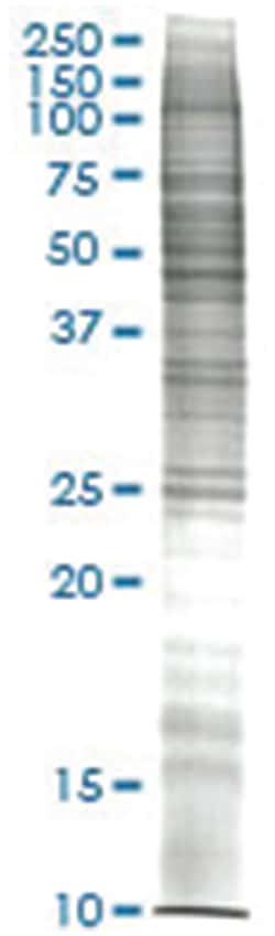 K-562 (human chronic myelogenous leukemia) Nuclear extract lysate, Non-denatured; Abnova 50 &mu;g | Buy Online | Abnova | Fisher Scientific