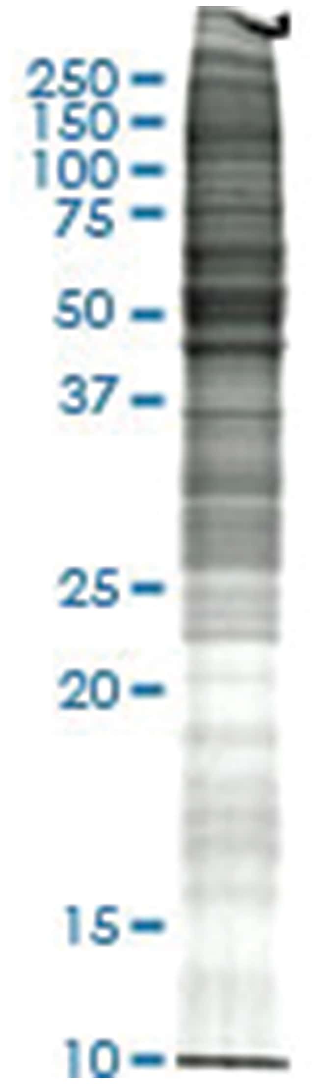 A 431 Human Epidermoid Carcinoma Whole Cell Lysate Non Denatured Abnova 0mg Human Cell Line Lysates Fisher Scientific