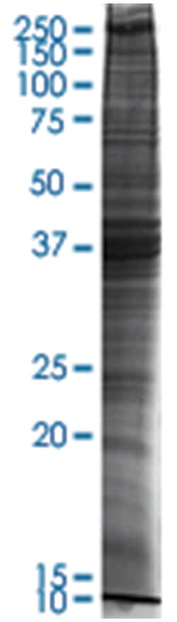 A-549 (human lung carcinoma) Nuclear extract lysate, Non-denatured; Abnova