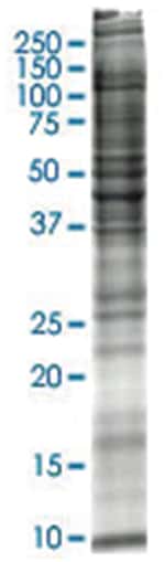 Abnova MCF-7 (human breast adenocarcinoma) Whole cell lysate, Denatured; Abnova