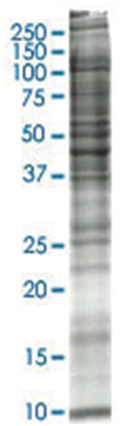 MCF-7(human breast adenocarcinoma) Whole cell lysate, Non-denatured; Abnova
