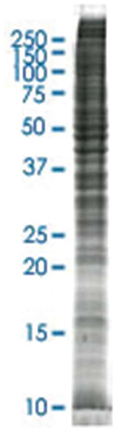 SKOV-3 (human adenocarcinoma) Whole cell lysate, Non-denatured; Abnova