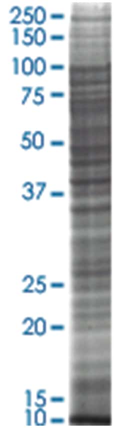 HCT 116 (human colorectal carcinoma) Whole cell lysate, Non-denatured; Abnova