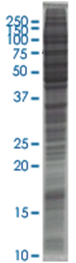 B16-F10 (mouse skin melanoma) Whole cell lysate, Non-denatured; Abnova