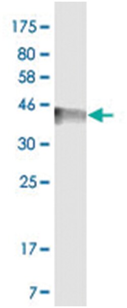 anti-TNFRSF10C, Clone: 8B8, Abnova 100 &mu;g | Buy Online | Abnova Corporation | Fisher Scientific
