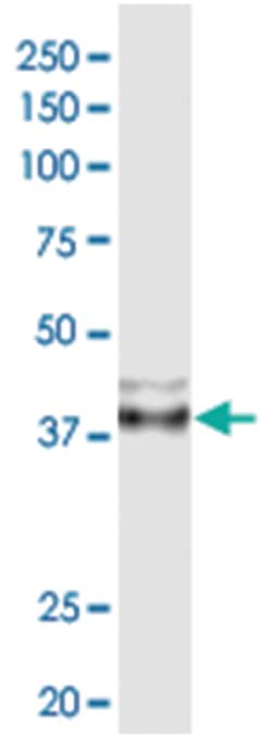 anti-BKV VP1, Clone: 1C7, Abnova 100&mu;g, Unlabeled:Antibodies, Monoclonal