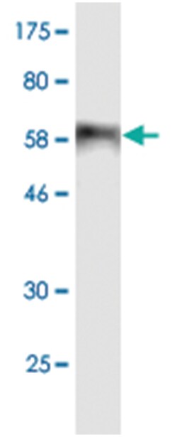 anti-BKV VP1, Clone: 2A12, Abnova 100 &mu;g | Buy Online | Abnova | Fisher Scientific