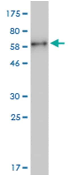anti-BKV VP1, Clone: 2C4, Abnova 100&mu;g, Unlabeled:Antibodies, Monoclonal