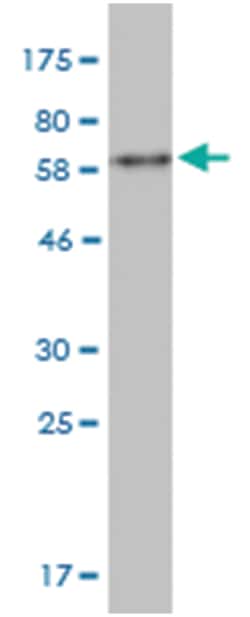 anti-BKV VP1, Clone: 2B9, Abnova 100&mu;g, Unlabeled:Antibodies, Monoclonal