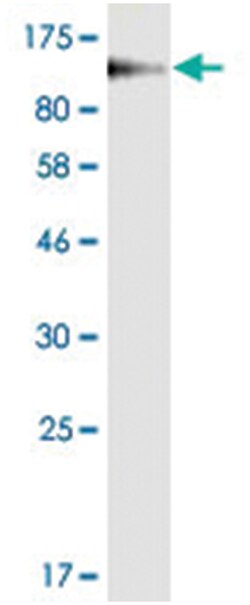 anti-HA, Clone: 3G4, Abnova 100 &mu;g | Buy Online | Abnova | Fisher Scientific