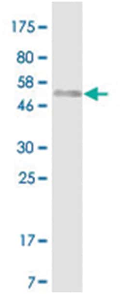 anti-CD86, Clone: 3E5., Abnova 100&mu;g, Unlabeled:Antibodies, Monoclonal