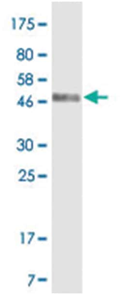 anti-CD86, Clone: 4B11, Abnova 100 &mu;g | Buy Online | Abnova Corporation | Fisher Scientific
