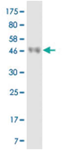 anti-CD86, Clone: 2E6., Abnova 100&mu;g, Unlabeled:Antibodies, Monoclonal