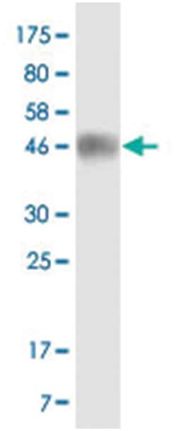 anti-CD86, Clone: 4B6, Abnova 100 &mu;g | Buy Online | Abnova Corporation | Fisher Scientific