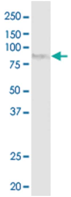 anti-HA, Clone: 2E5., Abnova 100 &mu;g | Buy Online | Abnova Corporation | Fisher Scientific