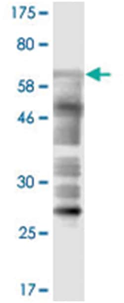 anti-EV71, Clone: 4E5., Abnova 100&mu;g, Unlabeled:Antibodies, Monoclonal