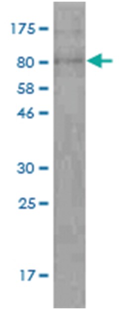 anti-Creatine Kinase MB, Clone: 8F8, Abnova 100 &mu;g | Buy Online | Abnova Corporation | Fisher Scientific