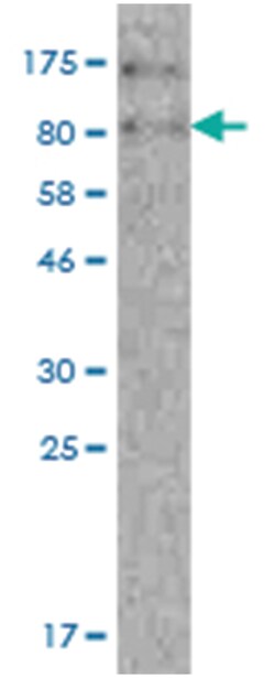 anti-Creatine Kinase MB, Clone: 8H6, Abnova 100 &mu;g | Buy Online | Abnova Corporation | Fisher Scientific