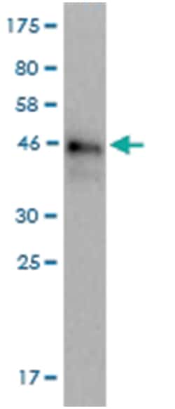 anti-Creatine Kinase MB, Clone: 5H2, Abnova 100&mu;g, Unlabeled:Antibodies,