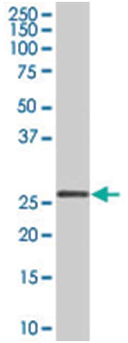 GST protein, Rabbit, Polyclonal Antibody, Abnova 100μg; Unlabeled:Antibodies,