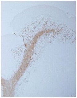 CNP, Chicken, Polyclonal Antibody, Abnova 100 &mu;g | Buy Online | Abnova | Fisher Scientific