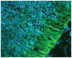 NES, Chicken, Polyclonal Antibody, Abnova 300&mu;g; Unlabeled:Antibodies,