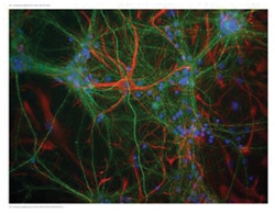 NEFM Chicken anti-Mouse, Polyclonal Antibody, Abnova 200 &mu;L | Buy Online | Abnova Corporation | Fisher Scientific