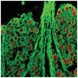 hCG_1776007, Chicken, Polyclonal Antibody, Abnova 100 &mu;g | Buy Online | Abnova Corporation | Fisher Scientific