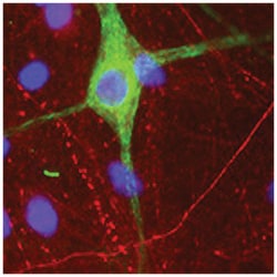 PRPH, Chicken, Polyclonal Antibody, Abnova 200 &mu;L | Buy Online | Abnova Corporation | Fisher Scientific