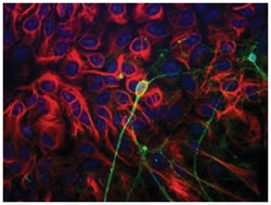 TUBB3, Chicken, Polyclonal Antibody, Abnova 300 &mu;g | Buy Online | Abnova Corporation | Fisher Scientific