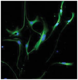 VIM Chicken anti-Human, Mouse, Polyclonal Antibody, Abnova 300 &mu;g | Buy Online | Abnova | Fisher Scientific