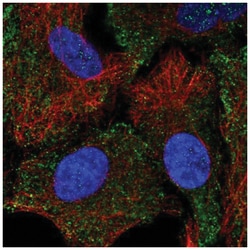 5-HT1B Antibody, Novus Biologicals 25 &mu;L:Antibodies, Polyclonal