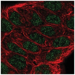 5-Lipoxygenase Antibody, Novus Biologicals 25 &mu;L:Antibodies, Polyclonal