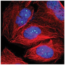 53BP1 Antibody, Novus Biologicals 25 &mu;L:Antibodies, Polyclonal