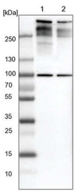 53BP1 Antibody, Novus Biologicals 25 &mu;L:Antibodies, Polyclonal