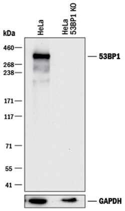 Human 53BP1 Antibody, R D Systems 25&mu;g; Unlabeled:Antibodies, Monoclonal