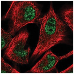 6 Phosphofructo 2 Kinase Antibody, Novus Biologicals 100&mu;L; Unlabeled:Antibodies,